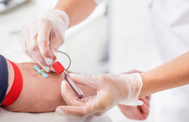 Lipid Profile Test